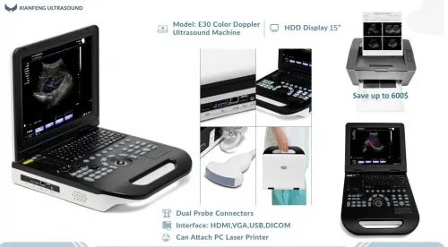 Le plus fiable , le plus rentable l'ECHOGRAPHIE PORTABLE Doppler Couleur XIANFENG E30 
