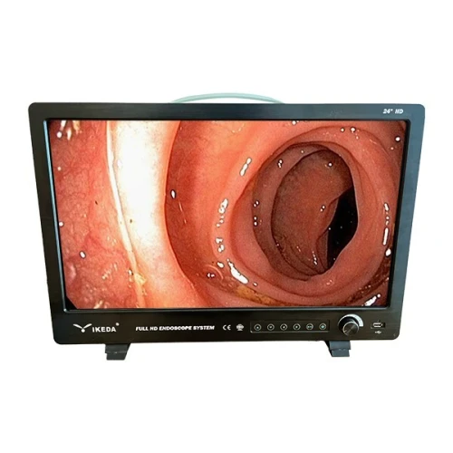 Endoscope caméra Ikeda 32 ou 24 pouces full HD All in One
