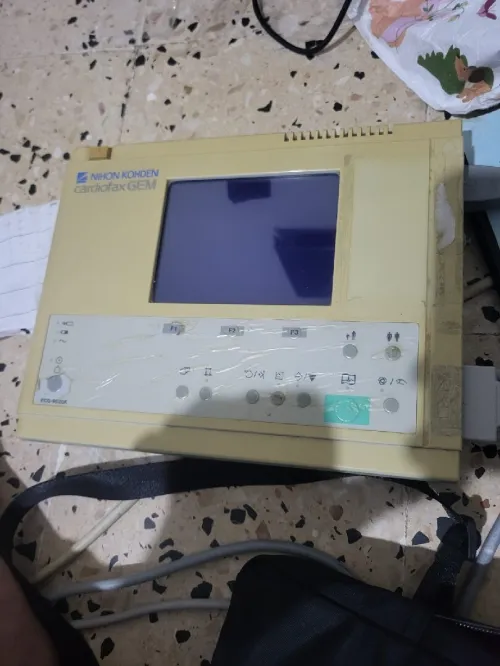 ECG 