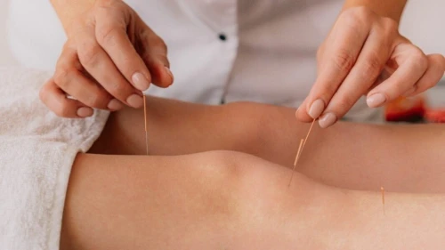 Acupuncture الطب الصيني و العلاج بالابر الصينية 