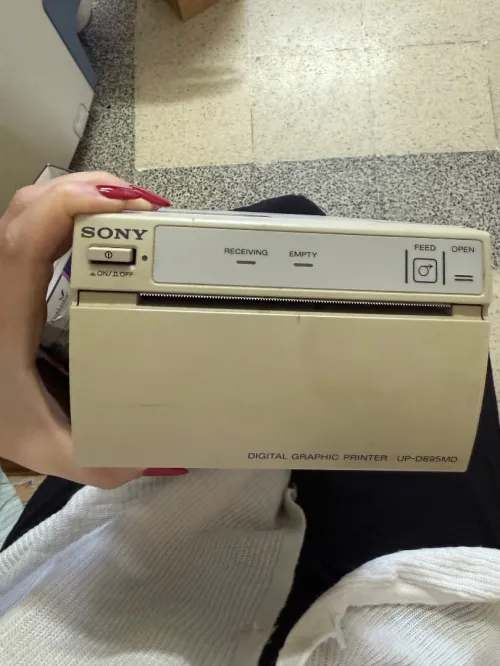 Echographe Toshiba