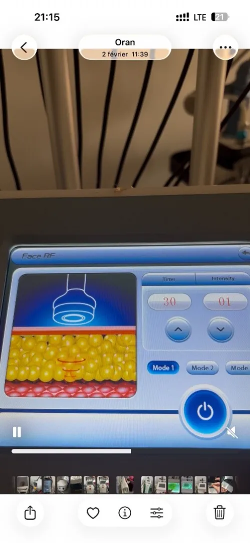Machine de cryothérapie Cryolipolyse