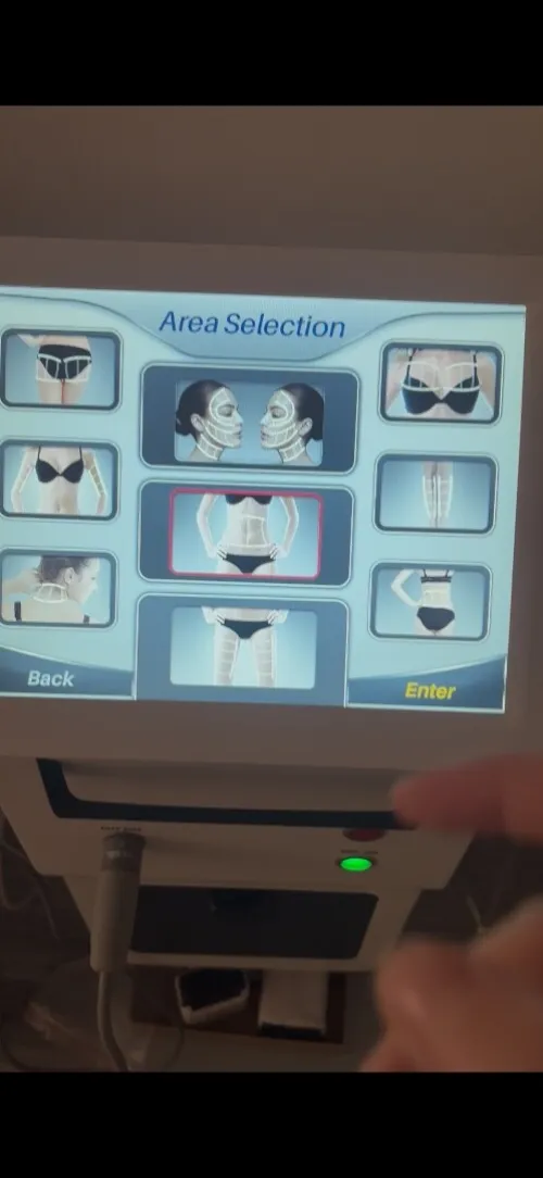 Hifu machine