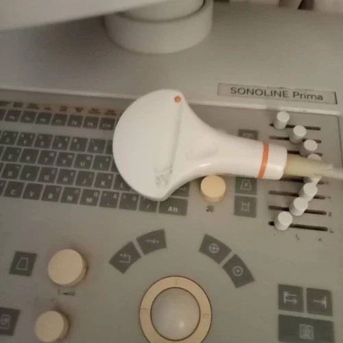 Echographe siemens SONOLINE prima 