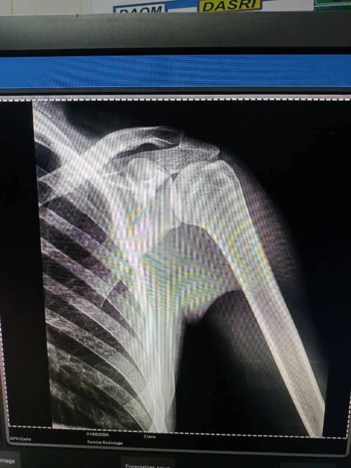 Appareil de radiologie 