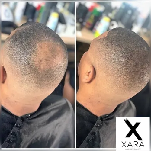 Fixateur de Fibres Capillaires- XARA
