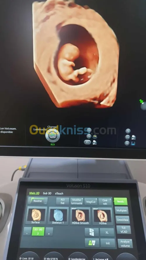 echographe GE volusson S10 à 4 sondes