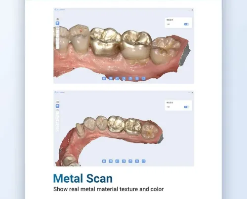 BLZ Dental Ino100 plus 