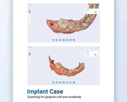 BLZ Dental Ino100 plus 