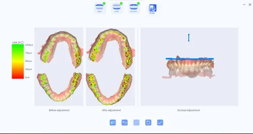 BLZ Dental Ino100 plus 