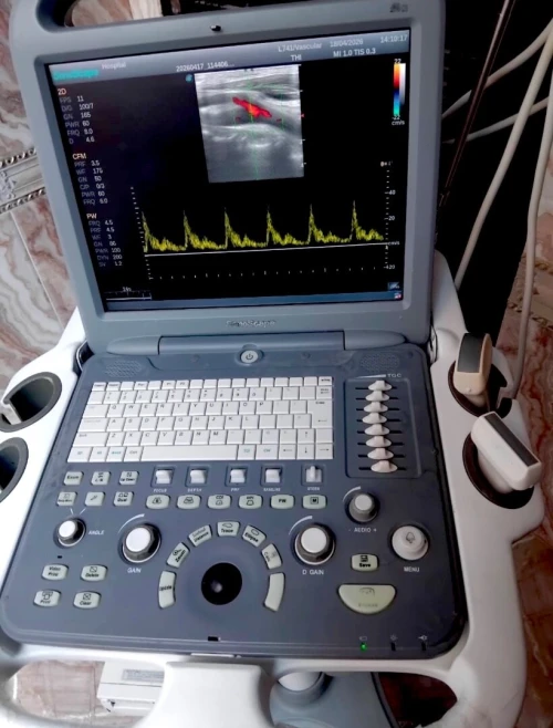 Échographe Sonoscape S2 Doppler couleur avec 2 sondes