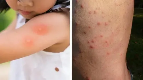 Extermination des punaises de lit بق الفراش à relizane 