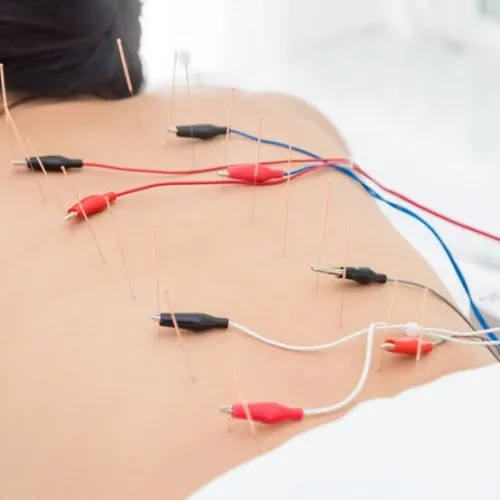 محفز كهربائي للإبر الصينية  Eléctrostimulateur d'acupuncture (Stimulateur)