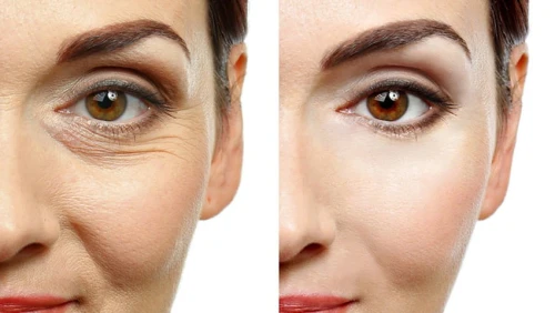 formation  dermo esthetique 