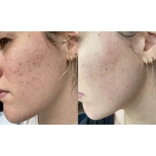 Cicalfate+ Avene original