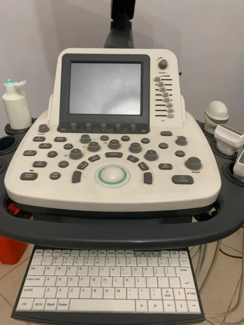 Échographe sonoscape s22