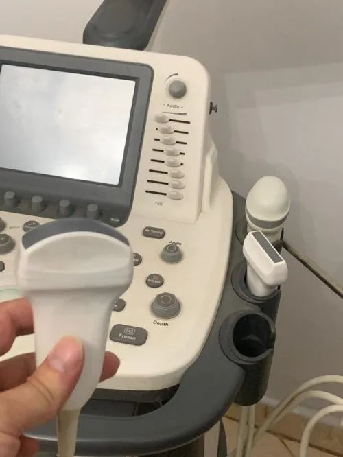 Échographe sonoscape s22