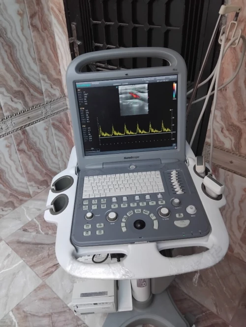 Echographe sonoscape S2