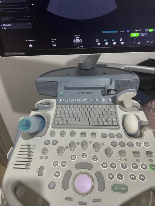 Échographe GE Healthcare voluson s6