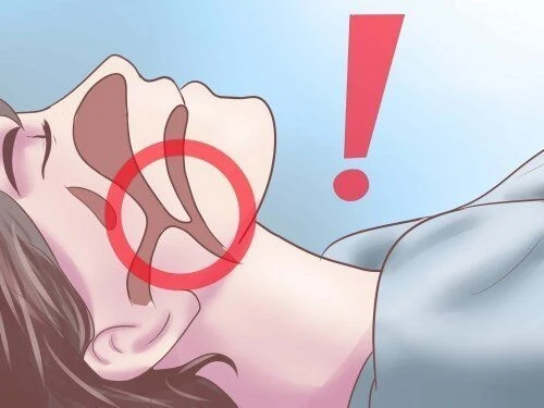 Formation apnée du sommeil 