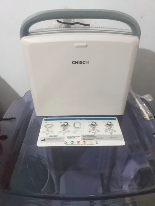 Echographie chison avec 1sonde nouveau 