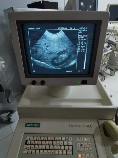 Echographe Siemens Sonoline SI-400 avec 2 sondes