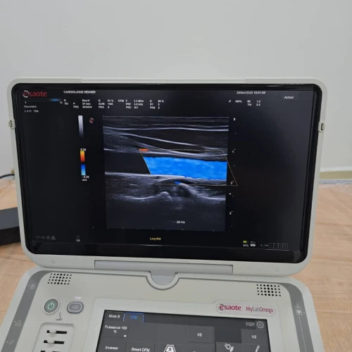 Échographe Esaote Omega 2020 avec 2 sondes Très bon état 180 millions DA