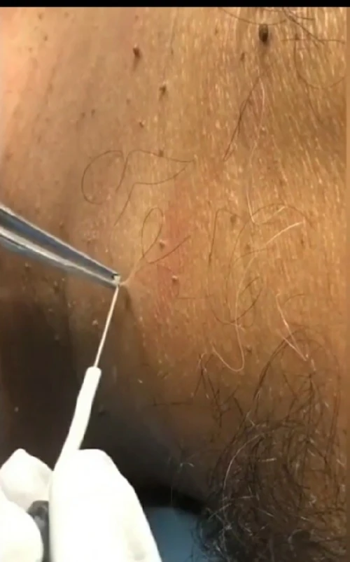 Podologie & petite chirurgie dermatologique