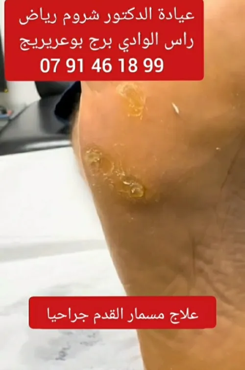 Podologie & petite chirurgie dermatologique