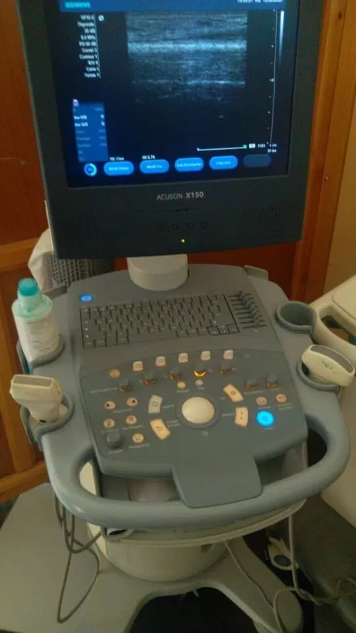 Échographie doppler 
