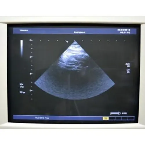 Echographe TOSHIBA Aplio 80
