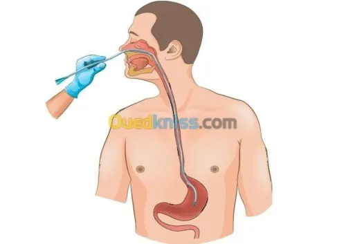 Placement de sonde urinaire et naso gastrique