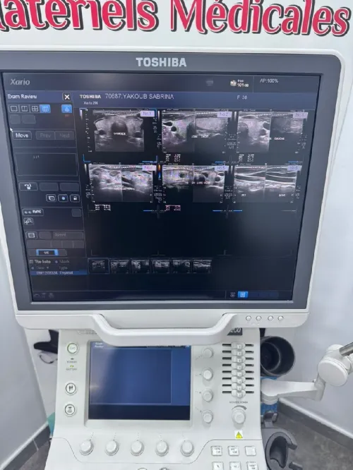 Echographe toshiba xario 200