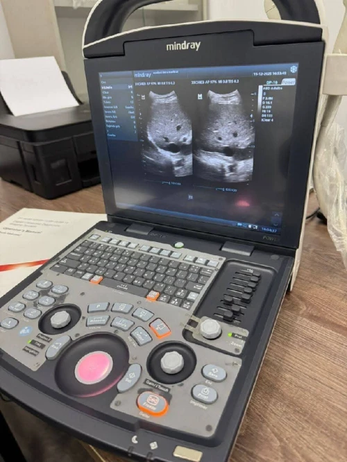 Echographe portatife mindray dp 10