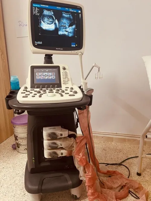 Échographie Sonoscape S22