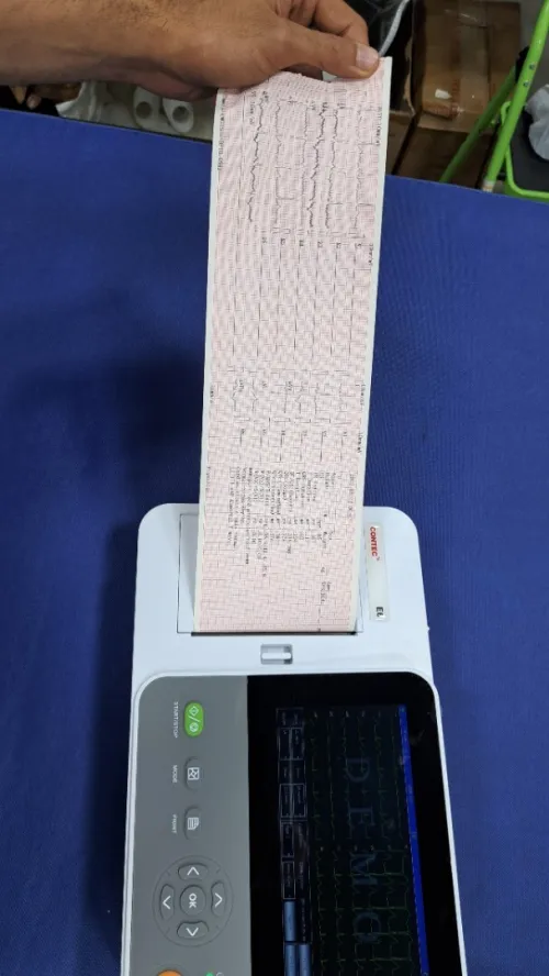 Electrocardiographe ECG Contec E6 (6 pistes) avec interprétation (Nouveau modèle)