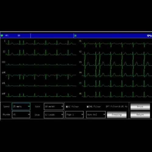 Electrocardiographe ECG Contec 600G (6 pistes) avec interprétation