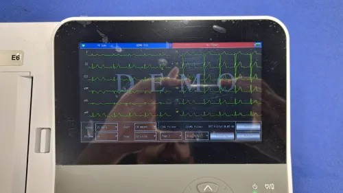 Electrocardiographe ECG Contec E6 (6 pistes) avec interprétation (Nouveau modèle)