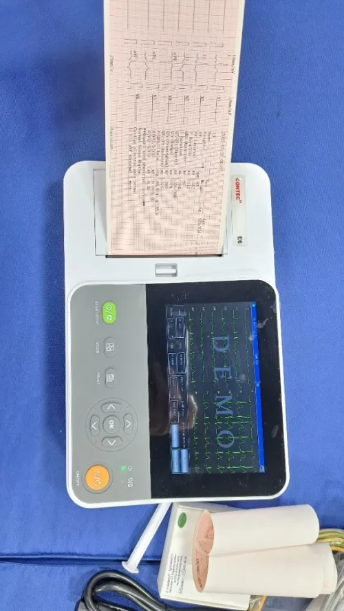 Electrocardiographe ECG Contec E6 (6 pistes) avec interprétation (Nouveau modèle)