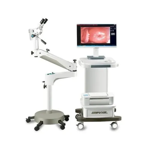 Colposcope vedio optique pour gynécologue 