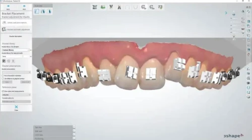 3Shape Dental System
