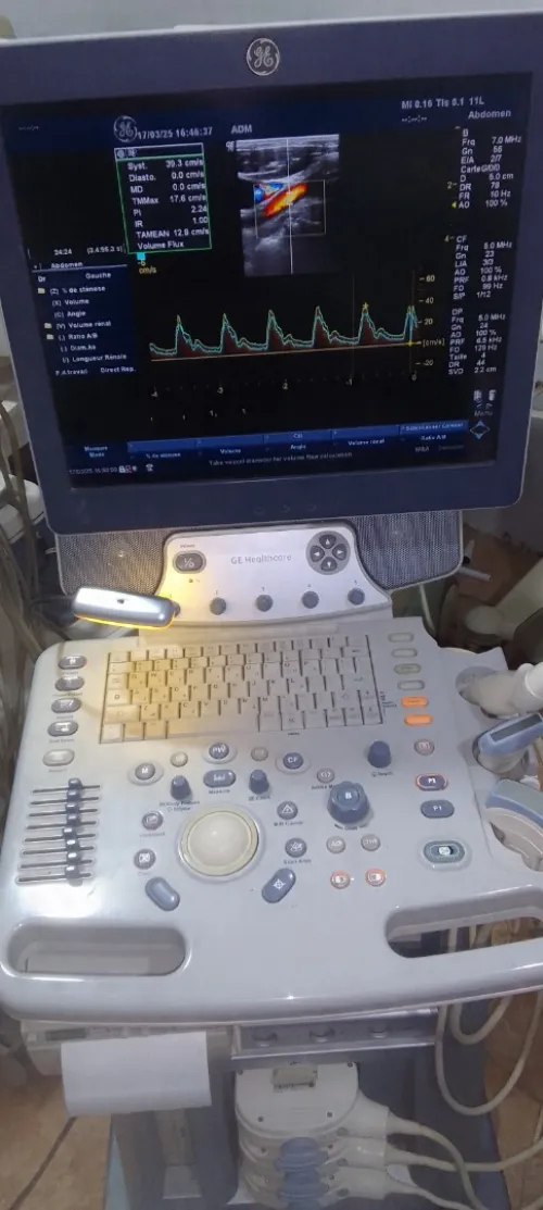 Echographe GE P6 