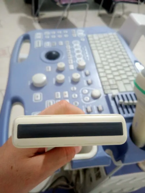 Échographie aloka SSD 3500 3D 4D