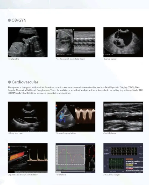 ECHOGRAPHE ALOKA ALPHA 6 