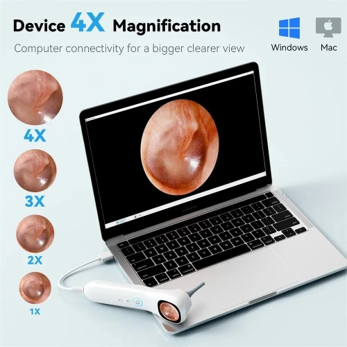 Caméra auriculaire otoscope HD 1080P sans fil كاميرا أذن عالية الدقة