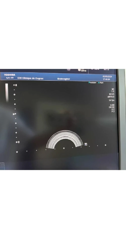 Sonde toshiba endo-vaginale 4D 