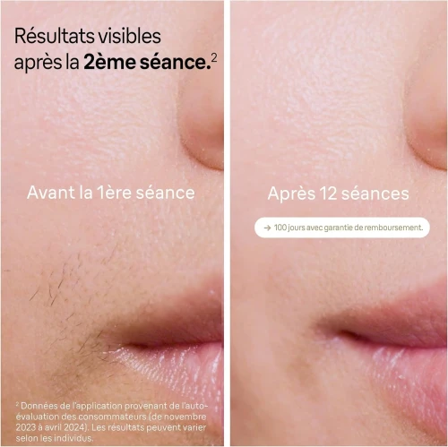 Braun Épilateur À Lumière Au Laser Rasoir Venus, 4 Têtes Pour Épiler Jambes, Visage, Maillot Et Plus