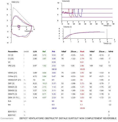 spirometre efr