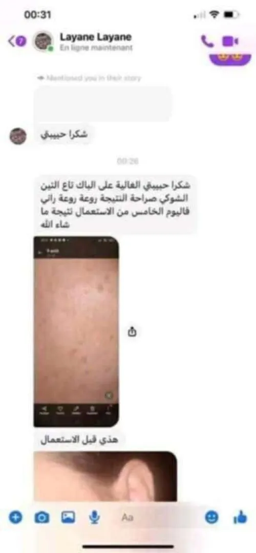 باقة التين الشوكي