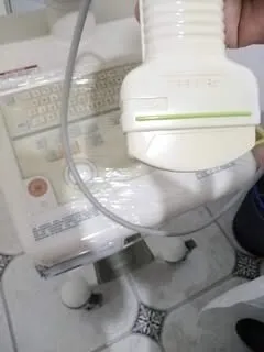 Vente échographe Toshiba avec imprimante